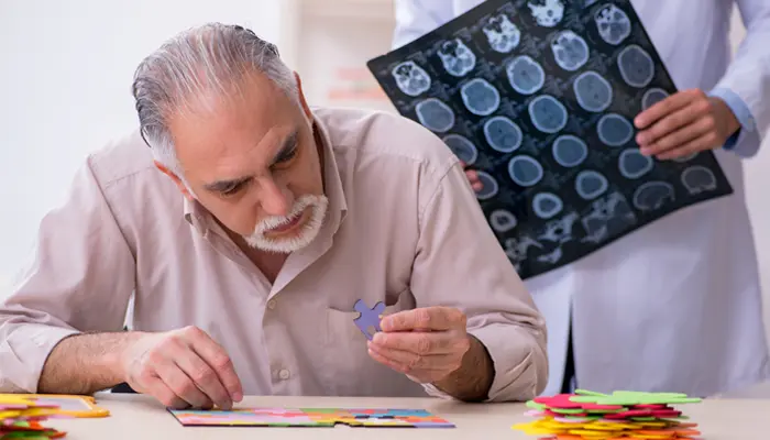 Bệnh Alzheimer là rối loạn thoái hóa thần kinh tác động đến trí nhớ