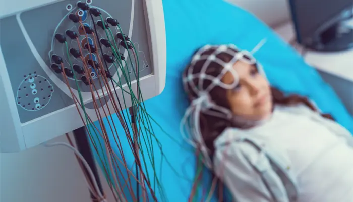 Chẩn đoán bệnh động kinh ở trẻ em với phương pháp điện não đồ