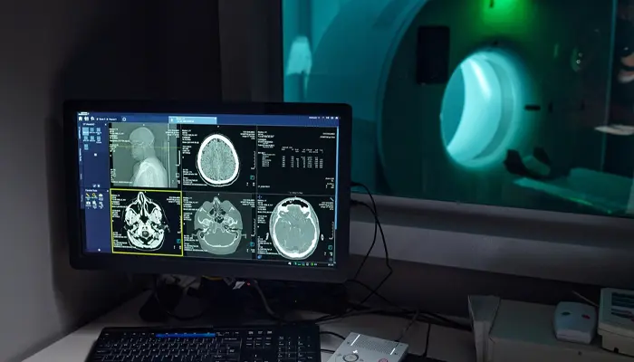 Chẩn đoán bệnh Alzheimer bằng phương pháp chụp MRI