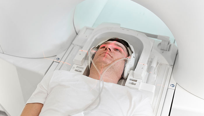 Chụp não chẩn đoán động kinh bằng MRI