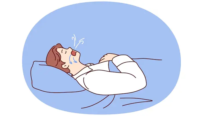 Hội chứng ngưng thở khi ngủ được chia làm 3 dạng chính