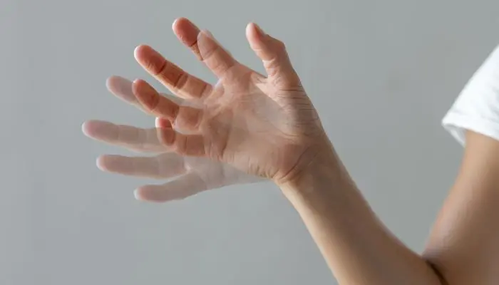 Triệu chứng bệnh Parkinson ở người trẻ run ở tay