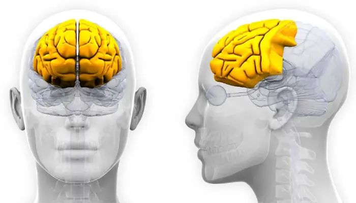 Động kinh thùy trán là dạng động kinh xuất phát từ thùy trán của não