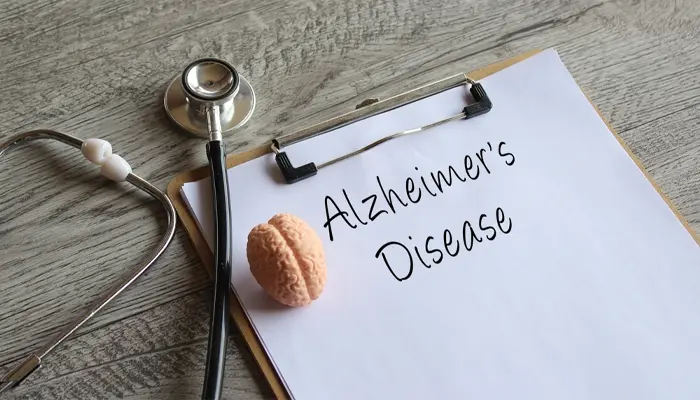 Bệnh Alzheimer được hình thành trải qua nhiều giai đoạn