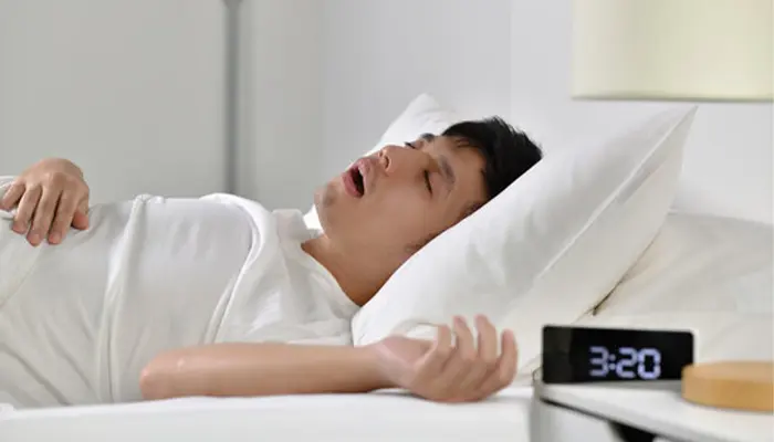 Hội chứng ngưng thở khi ngủ là tình trạng ngừng thở lặp lại khi ngủ
