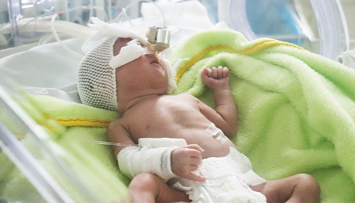 Khi mẹ bị động kinh mang thai cũng sẽ dẫn đến sinh non