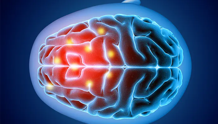 Chấn thương vùng đầu cũng là nguyên nhân gây co giật thùy thái dương 