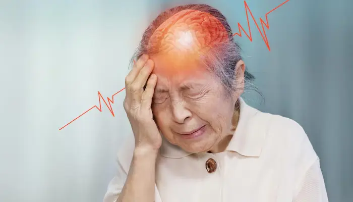 Tai biến mạch máu não là một trong số các nguyên nhân gây đau đầu mất ngủ