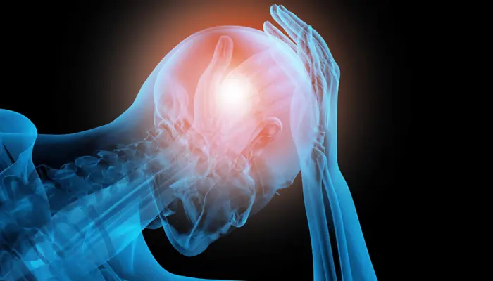 Chấn thương vùng đầu cũng là nguyên nhân gây động kinh cục bộ vận động 