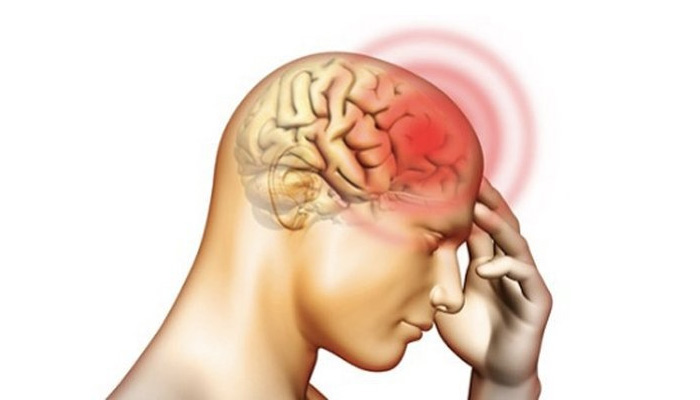 Nguyên nhân gây trạng thái động kinh từ tổn thương sọ não