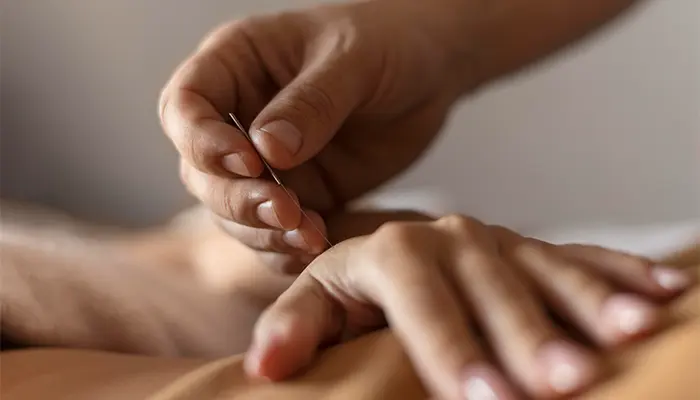 Bệnh Parkinson có châm cứu được không? Có thể áp dụng như liệu pháp bổ trợ