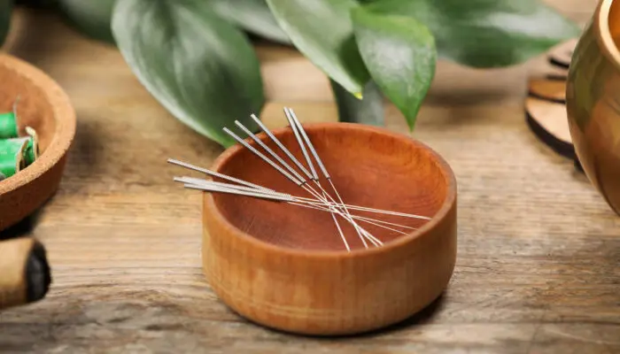Châm cứu chữa mất ngủ được thực hiện theo phác đồ hợp lý