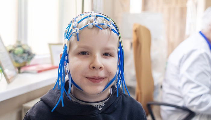 Chẩn đoán bệnh động kinh ở trẻ với điện não đồ