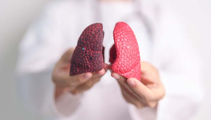 Tác hại của thuốc lá lâu dài gây ảnh hưởng đến phổi