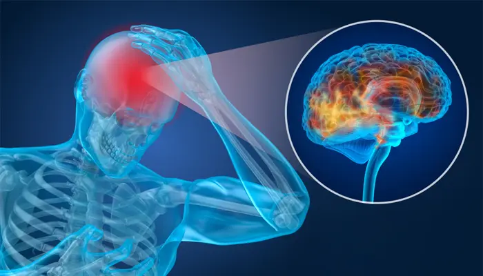 Trầm cảm sau chấn thương sọ não là tình trạng não tổn thương ảnh hưởng đến tâm lý