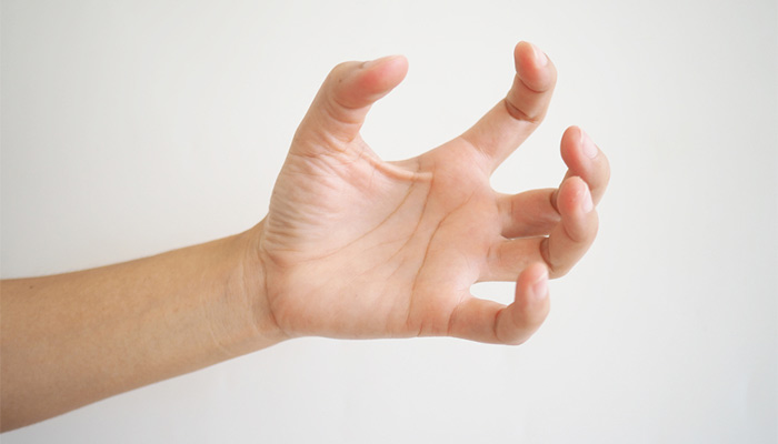 Triệu chứng bệnh động kinh cục bộ co giật ở một vùng tay