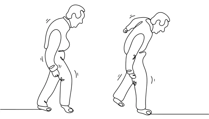 Người bệnh có biểu hiện đi không vững, chậm