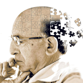 Bệnh Alzheimer là gì? Nguyên nhân, triệu chứng và cách điều trị hiệu quả