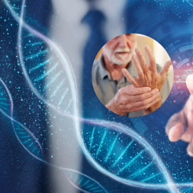 Bệnh Parkinson có di truyền không? Khi gia đình có người mắc