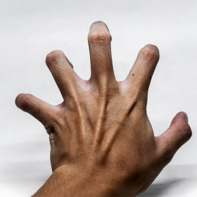 Các loại co giật thường gặp và cách xử trí đúng