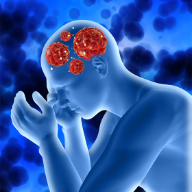 Nguyên nhân bệnh động kinh và các yếu tố nguy cơ