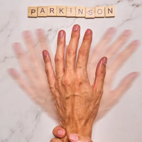 So sánh run vô căn và Parkinson khác nhau như thế nào? 